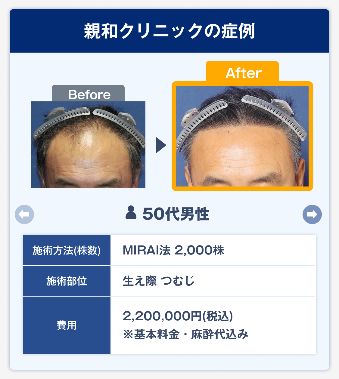 親和クリニックの症例4