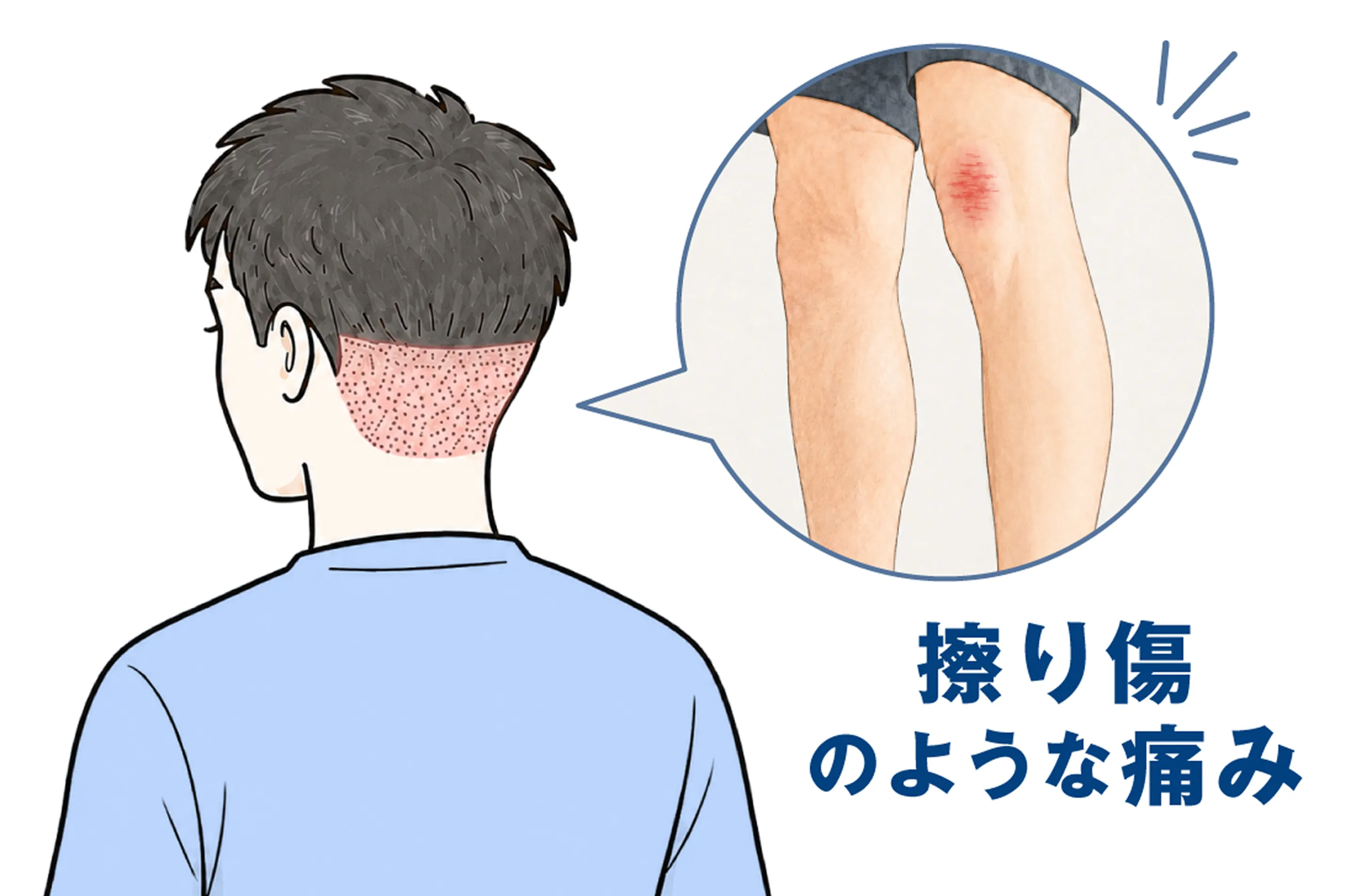 擦り傷のような痛み