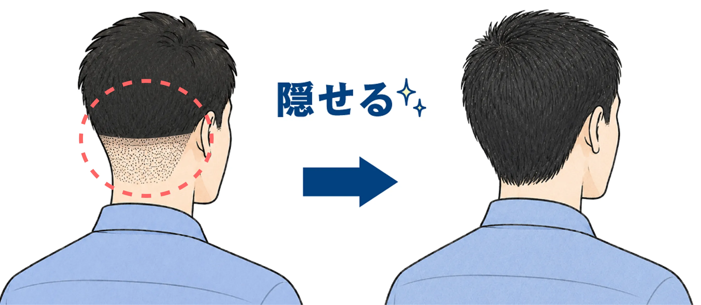 刈り上げ箇所を隠せる